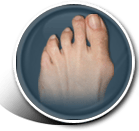 Bunion Icon